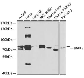 Western Blot - Anti-IRAK2 Antibody (A15310) - Antibodies.com