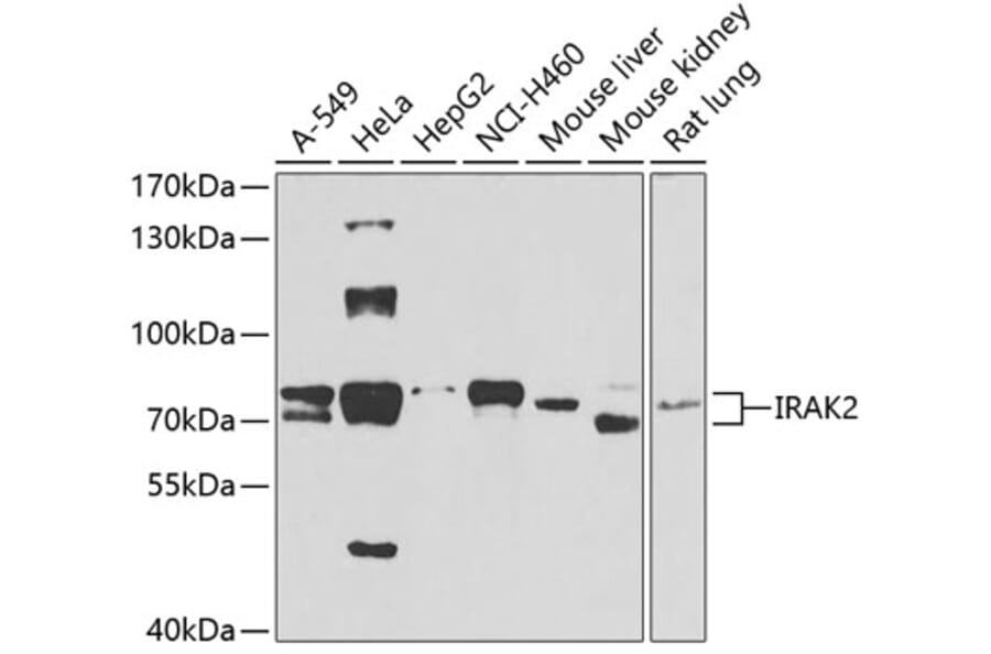 Western Blot - Anti-IRAK2 Antibody (A15310) - Antibodies.com