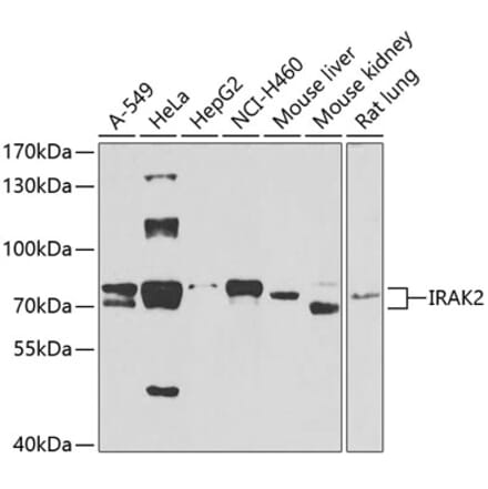 Western Blot - Anti-IRAK2 Antibody (A15310) - Antibodies.com