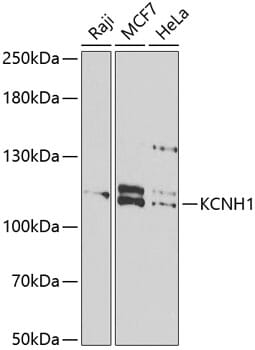 Western blot analysis of extracts of various cell lines, using Anti-KCNH1 Antibody (A6636) at 1:1,000 dilution.
Secondary antibody: Goat Anti-Rabbit IgG (H+L) (HRP) (AS014) at 1:10,000 dilution.
Lysates / proteins: 25µg per lane.
Blocking buffer: 3% non-fat dry milk in TBST.
Detection: ECL Basic Kit (RM00020).
Exposure time: 90s.