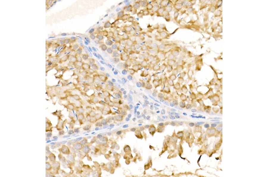 Immunohistochemistry - Anti-KIF3A Antibody (A15313) - Antibodies.com