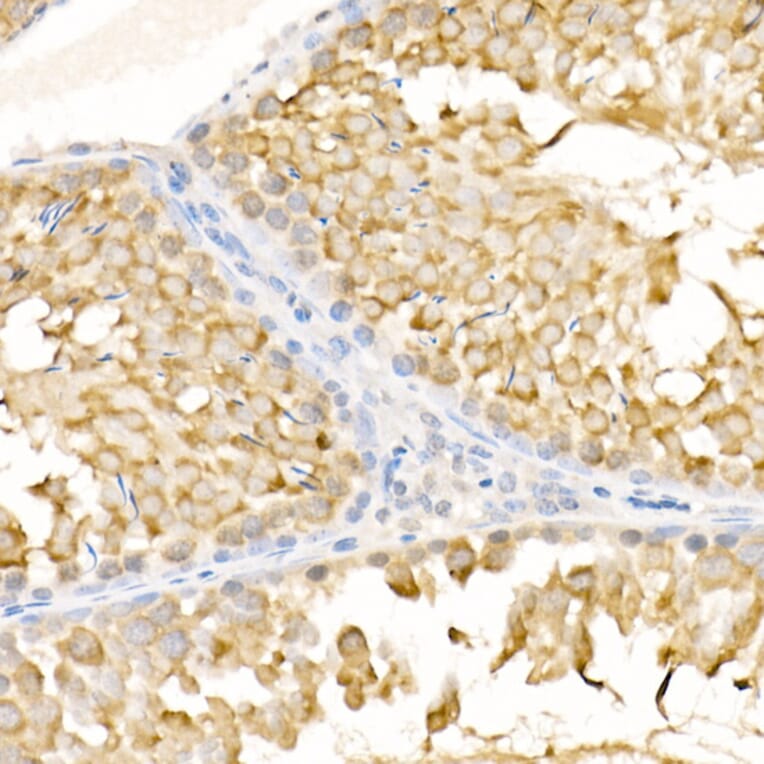Immunohistochemistry - Anti-KIF3A Antibody (A15313) - Antibodies.com