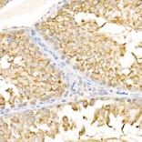 Immunohistochemistry - Anti-KIF3A Antibody (A15313) - Antibodies.com