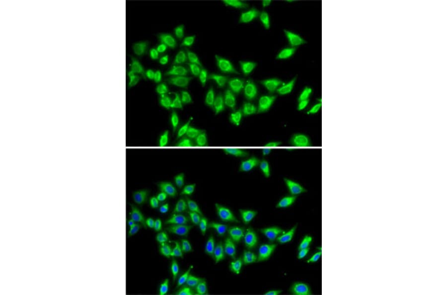 Immunofluorescence - Anti-KIF3A Antibody (A15313) - Antibodies.com