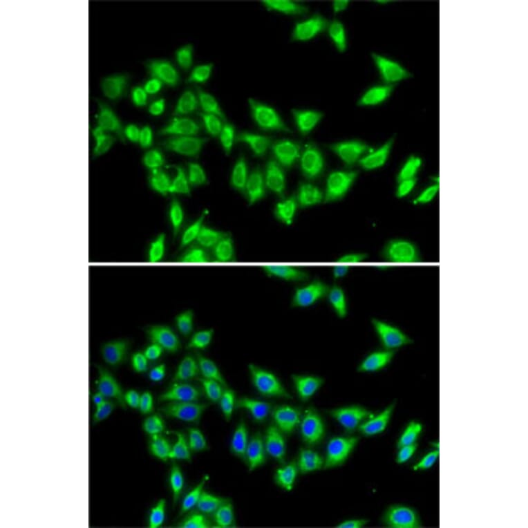 Immunofluorescence - Anti-KIF3A Antibody (A15313) - Antibodies.com