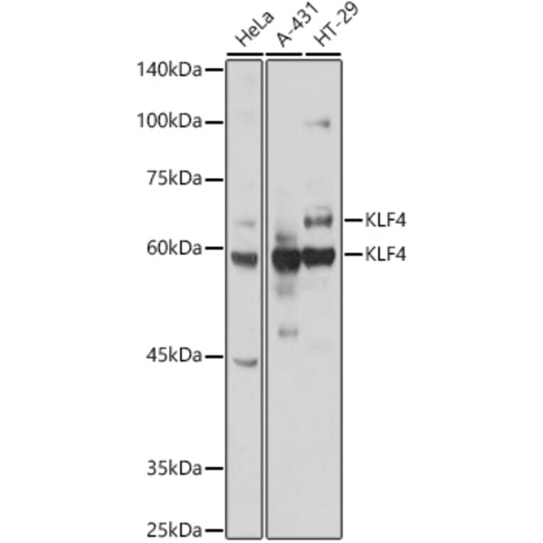 Western Blot - Anti-KLF4 Antibody (A15314) - Antibodies.com