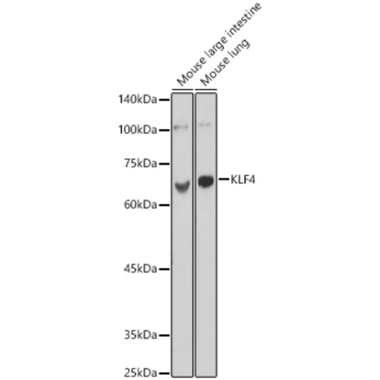 Western Blot - Anti-KLF4 Antibody (A15314) - Antibodies.com