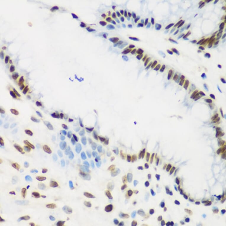 Immunohistochemistry - Anti-KLF4 Antibody (A15314) - Antibodies.com