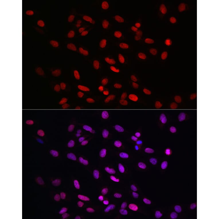 Immunofluorescence - Anti-KLF4 Antibody (A15314) - Antibodies.com