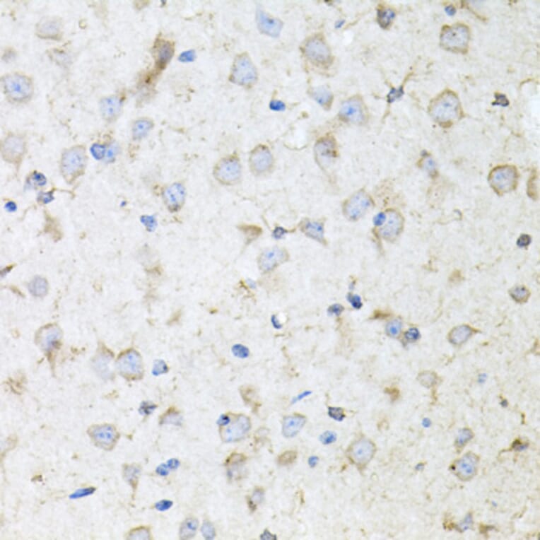 Immunohistochemistry - Anti-Kallikrein 11 Antibody (A15315) - Antibodies.com