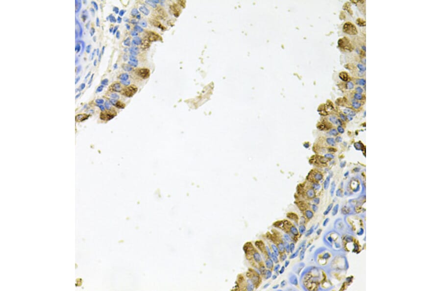 Immunohistochemistry - Anti-Kallikrein 11 Antibody (A15315) - Antibodies.com