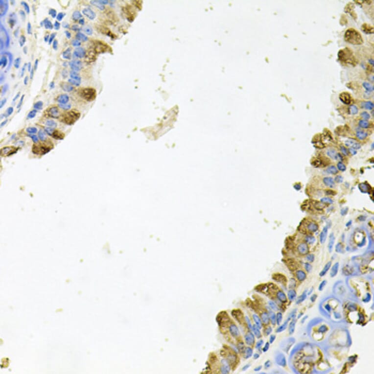 Immunohistochemistry - Anti-Kallikrein 11 Antibody (A15315) - Antibodies.com