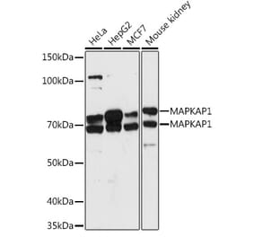 Western Blot - Anti-SIN1 Antibody (A15316) - Antibodies.com