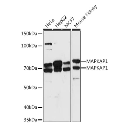 Western Blot - Anti-SIN1 Antibody (A15316) - Antibodies.com