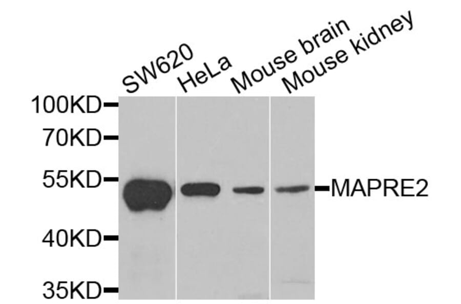 Western Blot - Anti-MAPRE2 Antibody (A6649) - Antibodies.com