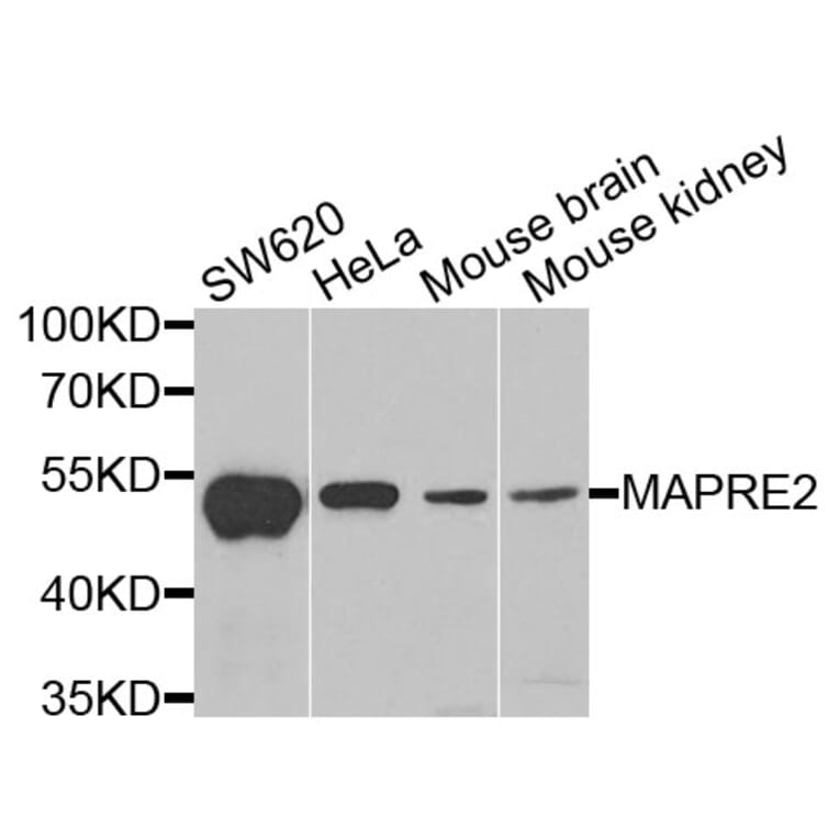 Western Blot - Anti-MAPRE2 Antibody (A6649) - Antibodies.com