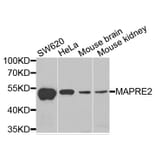 Western Blot - Anti-MAPRE2 Antibody (A6649) - Antibodies.com