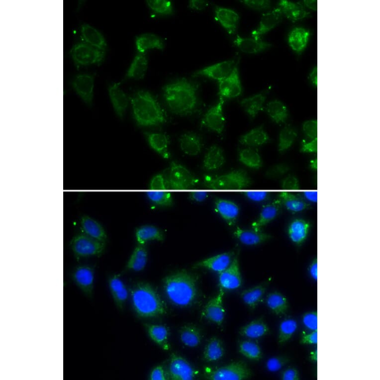 Immunofluorescence - Anti-MAPRE2 Antibody (A6649) - Antibodies.com