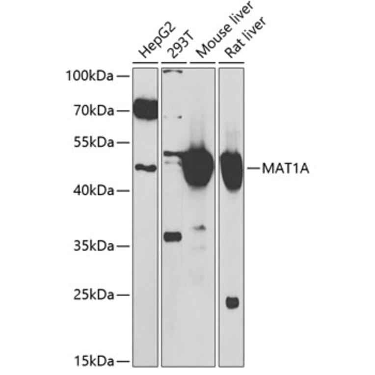 Western Blot - Anti-MAT1A Antibody (A15318) - Antibodies.com