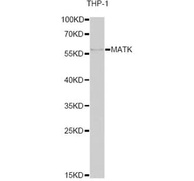 Western Blot - Anti-MATK Antibody (A6651) - Antibodies.com