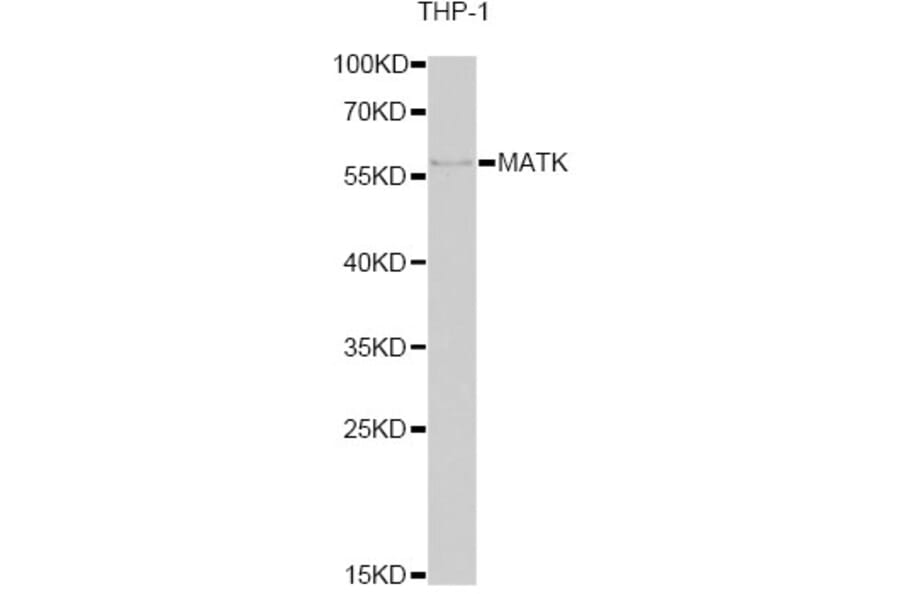 Western Blot - Anti-MATK Antibody (A6651) - Antibodies.com