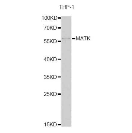 Western Blot - Anti-MATK Antibody (A15319) - Antibodies.com