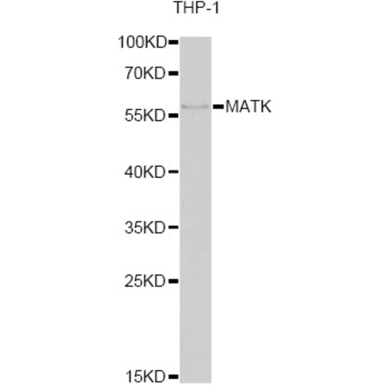 Western Blot - Anti-MATK Antibody (A6651) - Antibodies.com