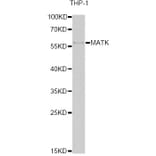 Western Blot - Anti-MATK Antibody (A6651) - Antibodies.com