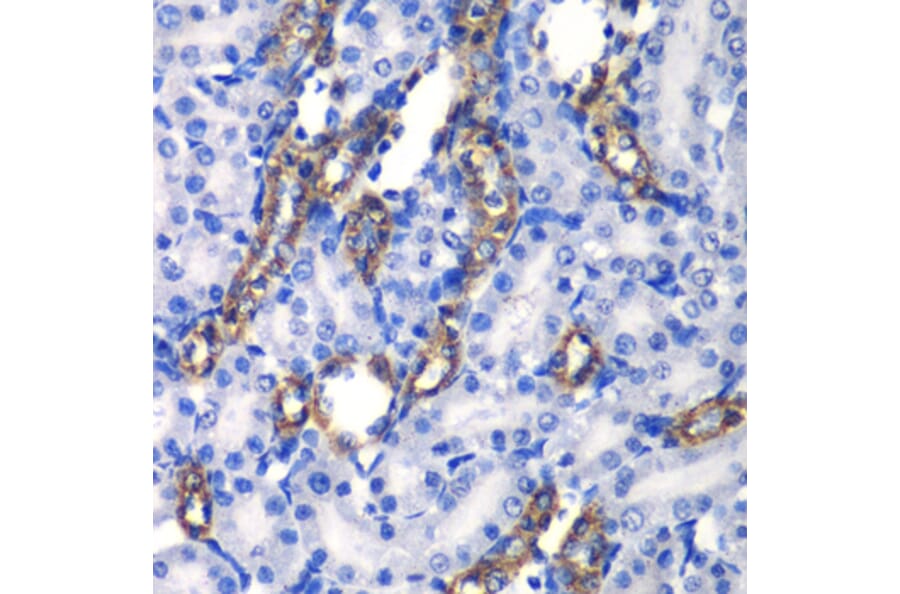 Immunohistochemistry - Anti-MATK Antibody (A6651) - Antibodies.com