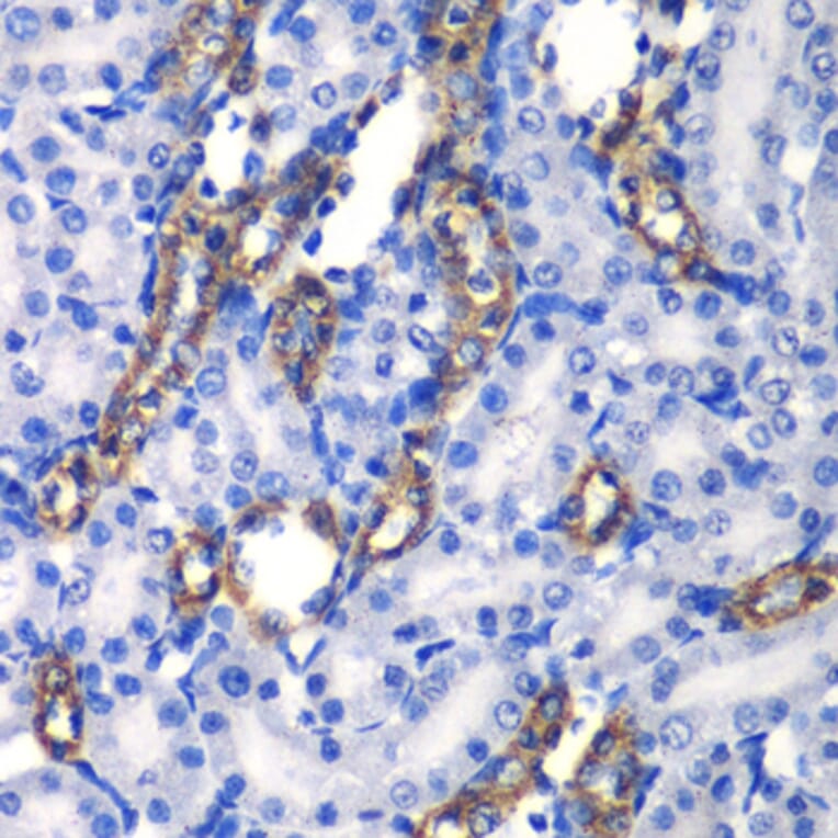 Immunohistochemistry - Anti-MATK Antibody (A6651) - Antibodies.com