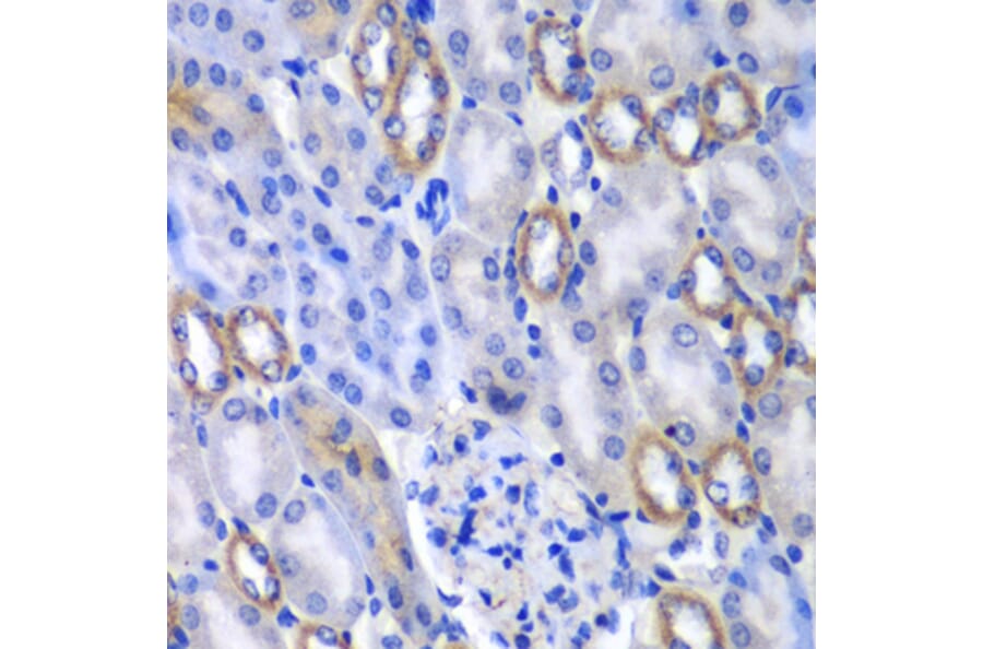 Immunohistochemistry - Anti-MATK Antibody (A6651) - Antibodies.com