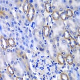 Immunohistochemistry - Anti-MATK Antibody (A6651) - Antibodies.com