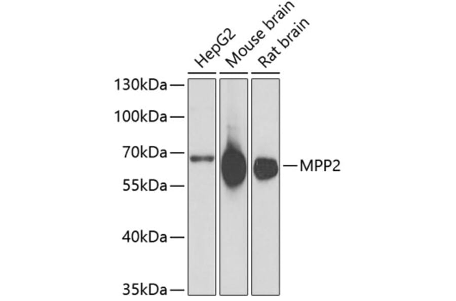 Western Blot - Anti-MPP2 Antibody (A6659) - Antibodies.com