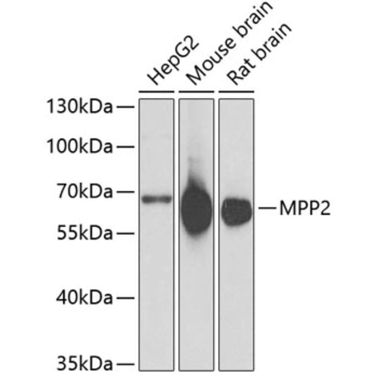 Western Blot - Anti-MPP2 Antibody (A6659) - Antibodies.com