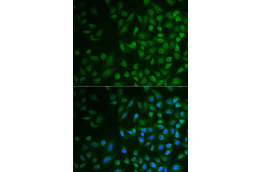Immunofluorescence - Anti-MPP2 Antibody (A6659) - Antibodies.com
