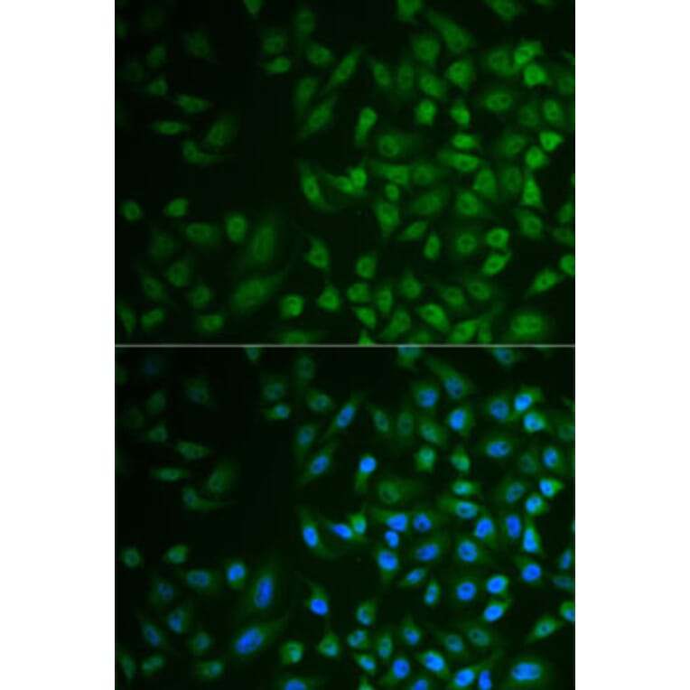 Immunofluorescence - Anti-MPP2 Antibody (A6659) - Antibodies.com