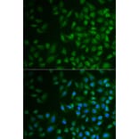 Immunofluorescence - Anti-MPP2 Antibody (A6659) - Antibodies.com