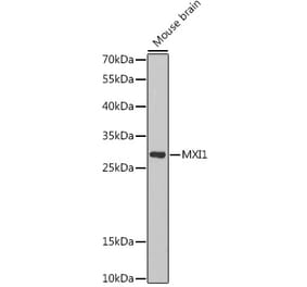 Western Blot - Anti-MXI1 Antibody (A15321) - Antibodies.com