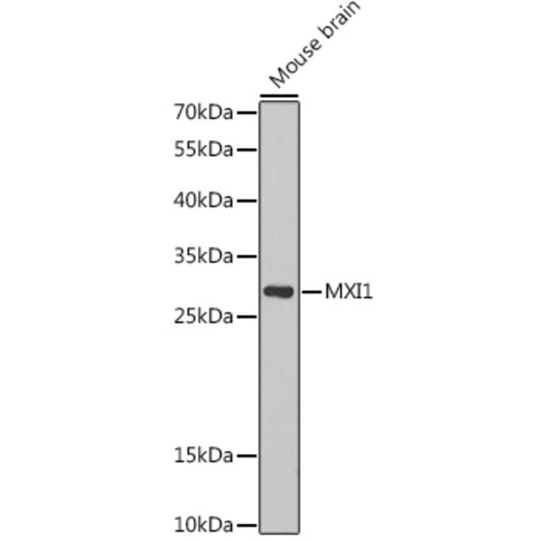 Western Blot - Anti-MXI1 Antibody (A15321) - Antibodies.com