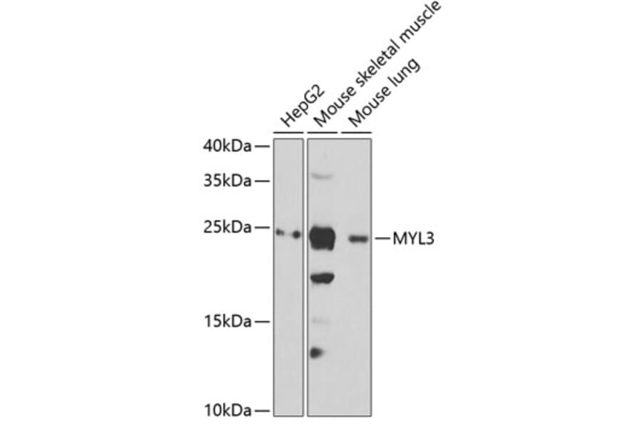 Western Blot - Anti-Myosin light chain 3 Antibody (A15322) - Antibodies.com