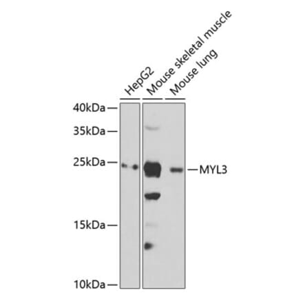 Western Blot - Anti-Myosin light chain 3 Antibody (A15322) - Antibodies.com