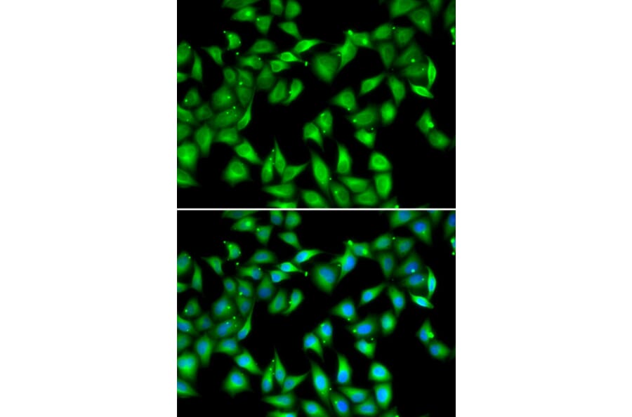 Immunofluorescence - Anti-Myosin light chain 3 Antibody (A15322) - Antibodies.com