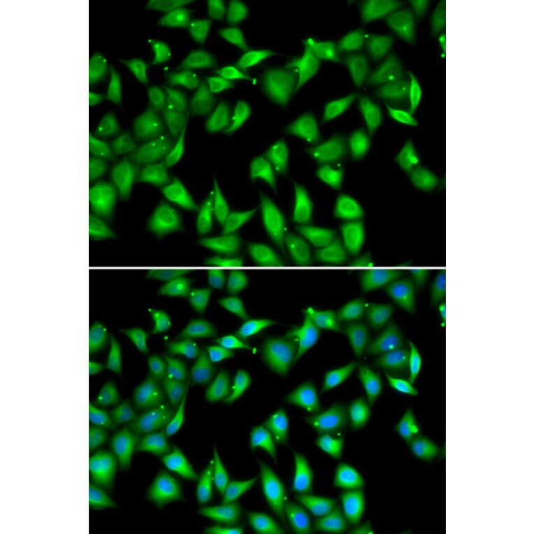Immunofluorescence - Anti-Myosin light chain 3 Antibody (A15322) - Antibodies.com
