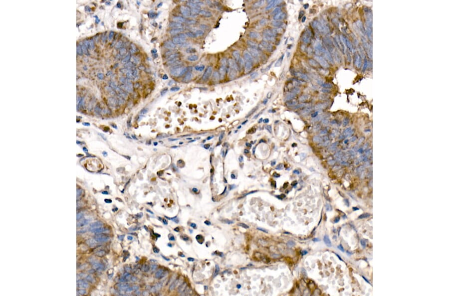 Immunohistochemistry - Anti-NFkB p105/p50 Antibody (A15324) - Antibodies.com