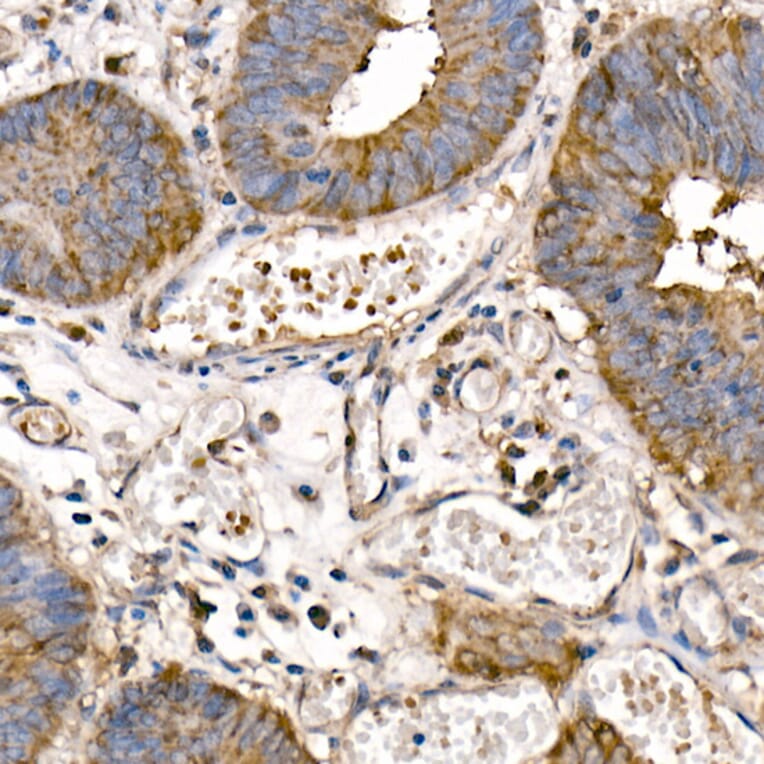Immunohistochemistry - Anti-NFkB p105/p50 Antibody (A15324) - Antibodies.com