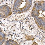 Immunohistochemistry - Anti-NFkB p105/p50 Antibody (A15324) - Antibodies.com