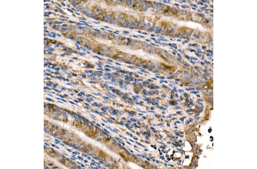 Immunohistochemistry - Anti-NFkB p105/p50 Antibody (A15324) - Antibodies.com