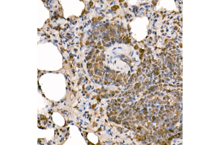 Immunohistochemistry - Anti-NFkB p105/p50 Antibody (A15324) - Antibodies.com