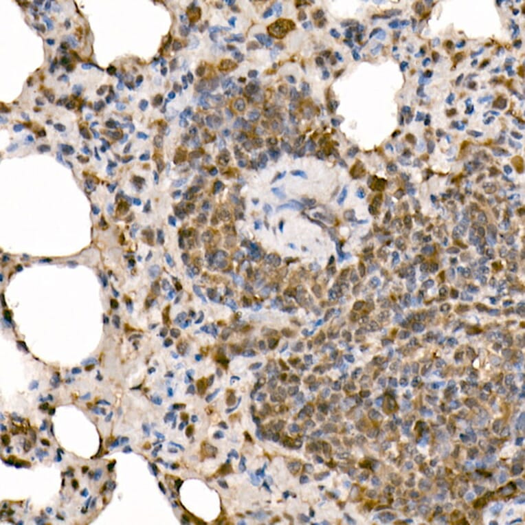 Immunohistochemistry - Anti-NFkB p105/p50 Antibody (A15324) - Antibodies.com