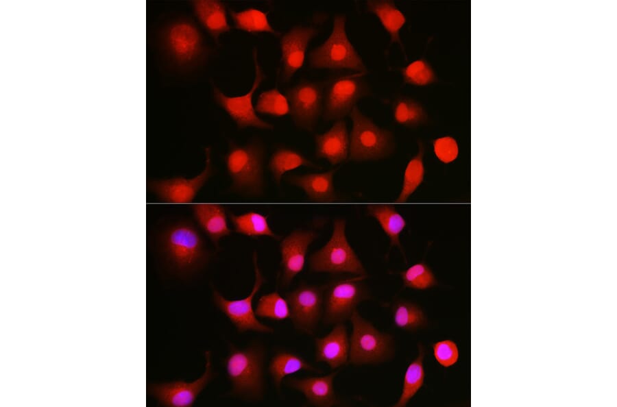 Immunofluorescence - Anti-NFkB p105/p50 Antibody (A15324) - Antibodies.com